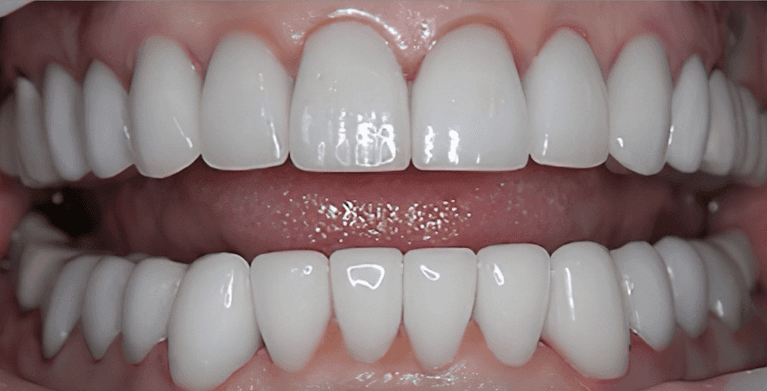 medium_after-case-13