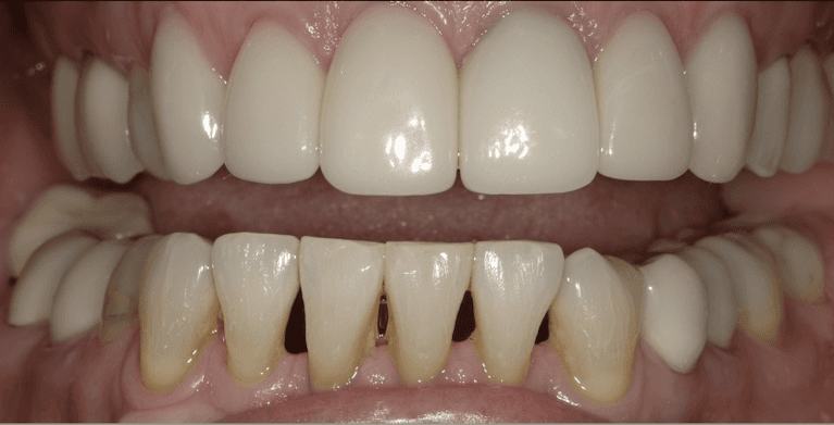 medium_before-case-10