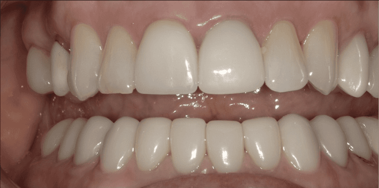 medium_before-case-11