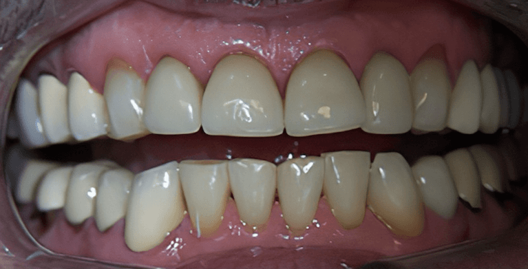 medium_before-case-13