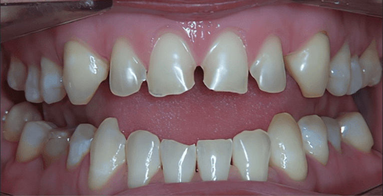 medium_before-case-18