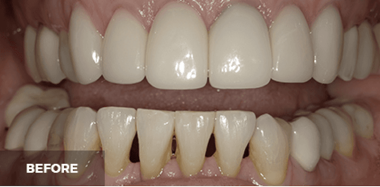 medium_before-case-21 (1)