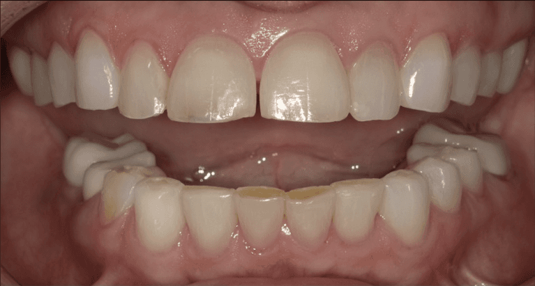 medium_before-case-6