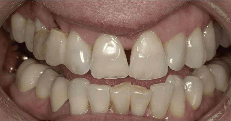 medium_before-case-8